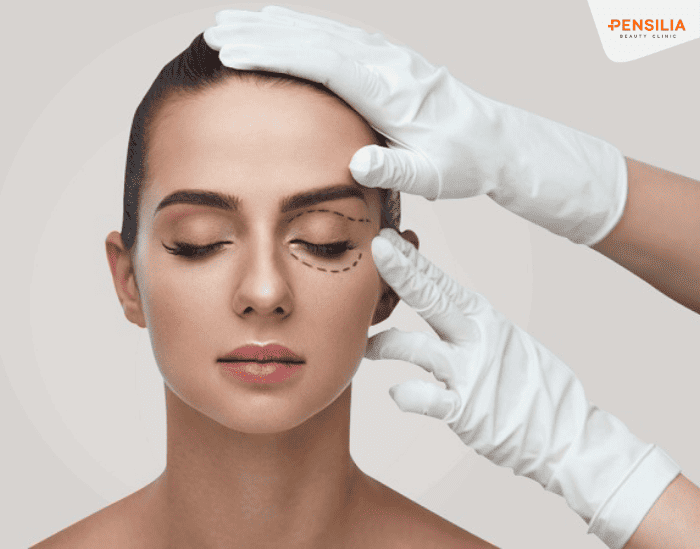 Kỹ thuật nhấn mí khá là đơn giản tuy nhiên để tránh những rủi ro bạn nên được thực hiện bởi các bác sĩ có chuyên môn 