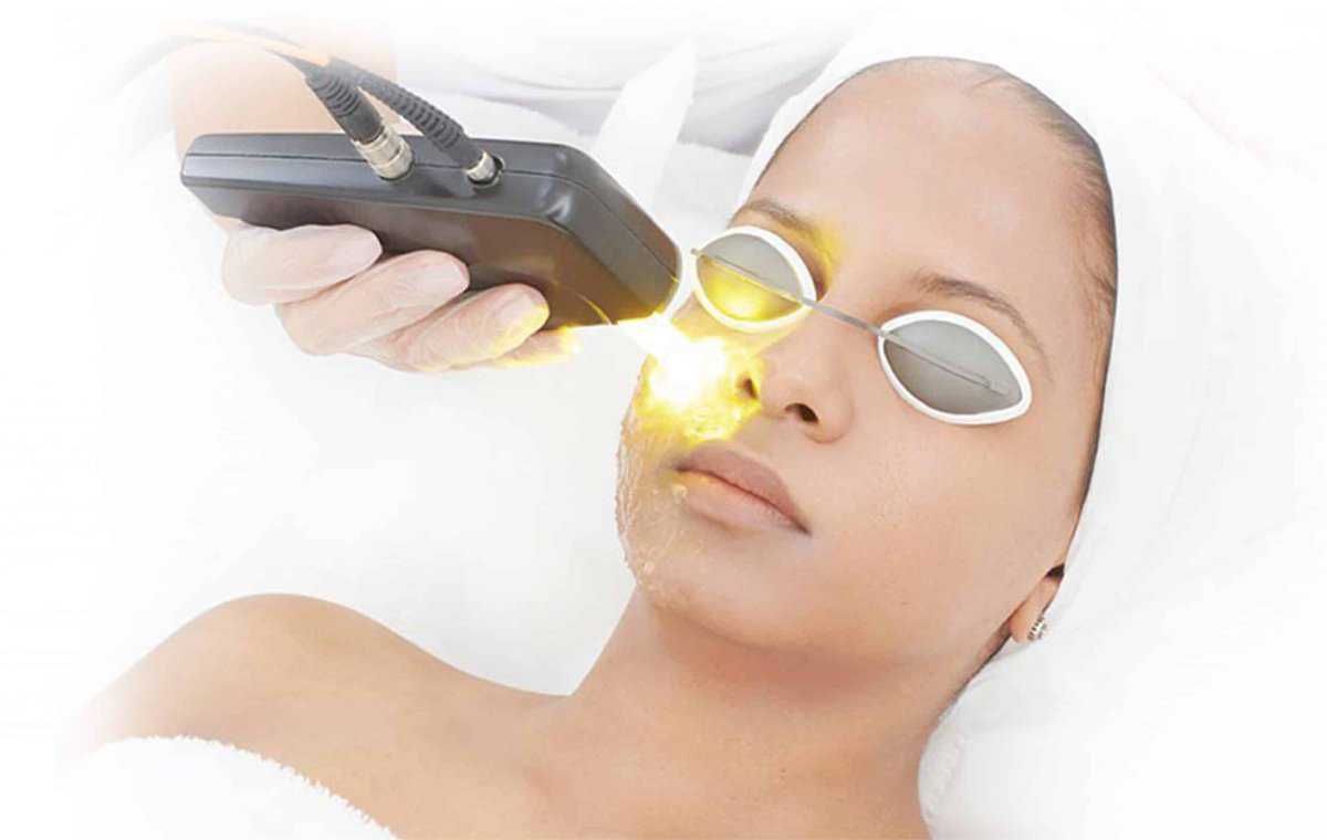 Laser đồng hiện là công nghệ có rất nhiều tính năng hiệu quả trong điều trị da